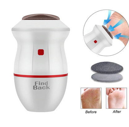 Removedor Eléctrico de Callos para Pies